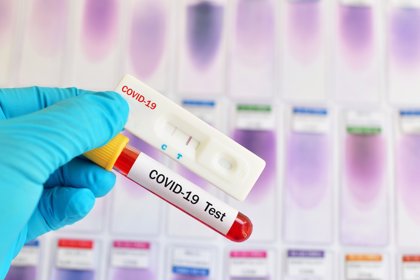 Test rápido coronavirus